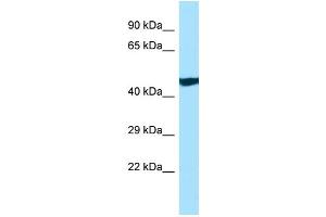 WB Suggested Anti-ANKRD33 Antibody Titration: 1. (ANKRD33 anticorps  (C-Term))