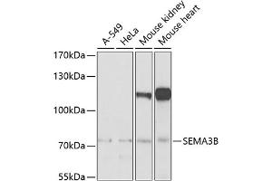 Western blot analysis of extracts of various cell lines, using SEMB Antibody (ABIN6132644, ABIN6147511, ABIN6147512 and ABIN6222774) at 1:1000 dilution. (SEMA3B anticorps  (AA 569-748))