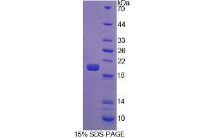 SDS-PAGE analysis of Human FGF22 Protein. (FGF22 Protéine)