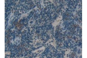 Detection of HMGB1 in Rat Spleen Tissue using Polyclonal Antibody to High Mobility Group Protein 1 (HMGB1) (HMGB1 anticorps  (AA 1-215))