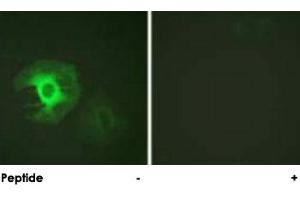 Immunofluorescence analysis of HeLa cells, using CALD1 polyclonal antibody . (Caldesmon anticorps)