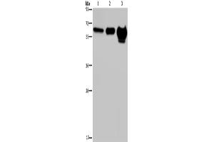 Western Blotting (WB) image for anti-Matrix Metalloproteinase 20 (MMP20) antibody (ABIN2435010)