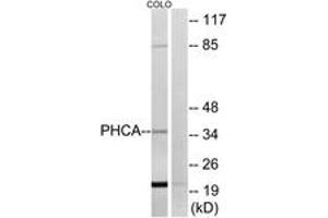 Western blot analysis of extracts from COLO cells, using PHCA Antibody. (ACER3 anticorps  (AA 171-220))