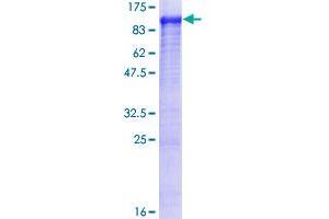 Image no. 1 for threonyl-tRNA Synthetase (TARS) (AA 1-723) protein (GST tag) (ABIN1322159)