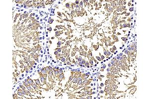 Immunohistochemistry analysis of paraffin-embedded rat testis using GLUT-3 Polyclonal Antibody at dilution of 1:400.
