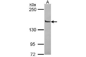 WB Image Sample (30 ug of whole cell lysate) A: JurKat 5% SDS PAGE antibody diluted at 1:10000 (PPFIA1 anticorps  (N-Term))