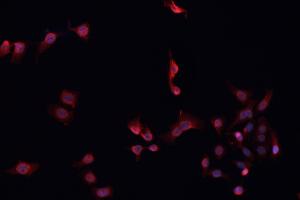 ABIN6268934 staining MCF-7 cells by IF/ICC. (FOXP3 anticorps  (C-Term))