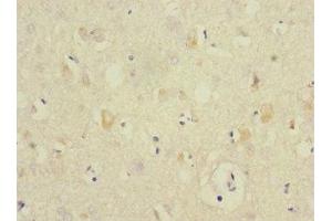 Immunohistochemistry of paraffin-embedded human brain tissue using ABIN7144207 at dilution of 1:100 (ANKS1B anticorps  (AA 999-1248))