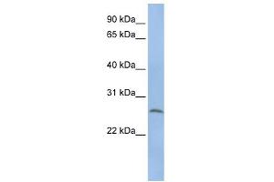 WB Suggested Anti-ELA1 Antibody Titration: 0. (CELA1 anticorps  (N-Term))