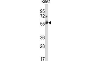 Western Blotting (WB) image for anti-Cbl proto-oncogene C (CBLC) antibody (ABIN2996838) (CBLC anticorps)