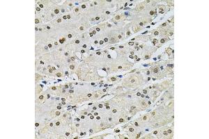 Immunohistochemistry of paraffin-embedded human stomach using H2AFZ antibody (ABIN5973977) at dilution of 1/100 (40x lens). (H2AFZ anticorps)