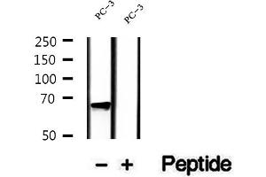 Western blot analysis of extracts of PC-3 cells, using LGTN antibody. (EIF2D anticorps  (Internal Region))