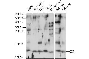 Western blot analysis of extracts of various cell lines, using OXT antibody (ABIN6293432) at 1:1000 dilution. (OXT anticorps)