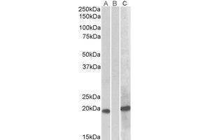 Western Blotting (WB) image for anti-Homeobox A1 (HOXA1) (Internal Region) antibody (ABIN2464864) (HOXA1 anticorps  (Internal Region))