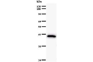 Western Blotting (WB) image for anti-AT Rich Interactive Domain 2 (ARID, RFX-Like) (ARID2) antibody (ABIN933106)
