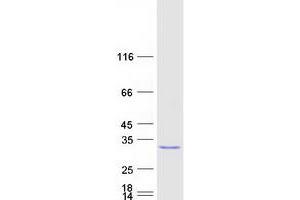 Validation with Western Blot