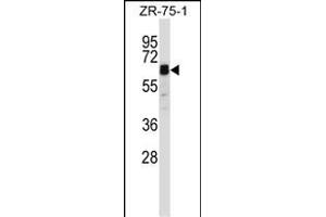 ST Antibody (Center) (ABIN657963 and ABIN2846909) western blot analysis in ZR-75-1 cell line lysates (35 μg/lane).