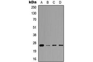 Western blot analysis of Prolactin expression in A549 (A), MCF7 (B), NS-1 (C), H9C2 (D) whole cell lysates. (Prolactin anticorps  (Center))