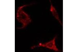 ABIN6278285 staining HepG2 cells by IF/ICC. (ENAH anticorps  (Internal Region))