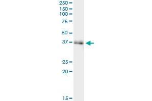 Immunoprecipitation of FAM62B transfected lysate using anti-FAM62B monoclonal antibody and Protein A Magnetic Bead , and immunoblotted with FAM62B monoclonal antibody.