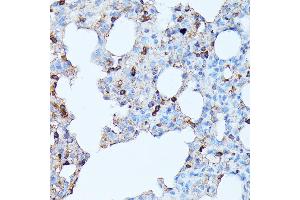 Immunohistochemistry of paraffin-embedded rat lung using CXCR1 antibody (ABIN7266317) at dilution of 1:100 (40x lens).