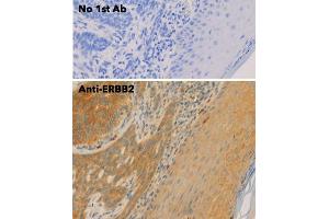 Immunohistochemistry (IHC) image for anti-Receptor tyrosine-protein kinase erbB-2 (ErbB2/Her2) (C-Term) antibody (ABIN6254225)