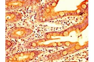IHC image of ABIN7142343 diluted at 1:400 and staining in paraffin-embedded human small intestine tissue performed on a Leica BondTM system.
