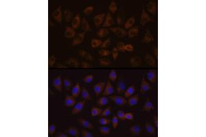Immunofluorescence analysis of L929 cells using HDLBP Rabbit pAb (ABIN6128051, ABIN6141701, ABIN6141702 and ABIN6221672) at dilution of 1:100 (40x lens).