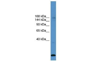 WB Suggested Anti-USP47  Antibody Titration: 0.