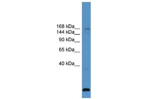 WB Suggested Anti-USP47  Antibody Titration: 0. (USP47 anticorps  (Middle Region))