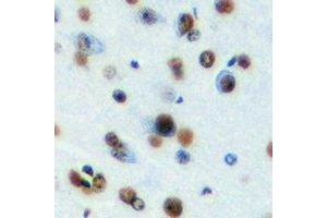 Immunohistochemical analysis of MeCP2 staining in mouse brain formalin fixed paraffin embedded tissue section.