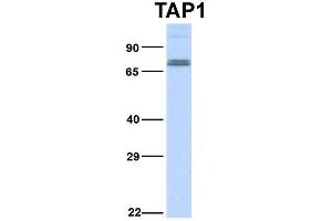 Host:  Rabbit  Target Name:  TAP1  Sample Type:  Hela  Antibody Dilution:  1. (TAP1 anticorps  (Middle Region))