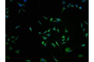 Immunofluorescence staining of SH-SY5Y cells with ABIN7168240-IF at 1:100, counter-stained with DAPI.