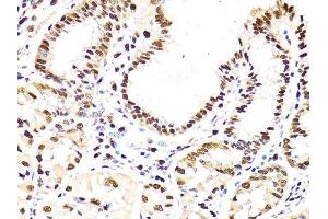 Immunohistochemistry of paraffin-embedded human stomach using PCNA antibody. (PCNA anticorps  (AA 1-261))