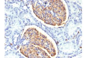 Formalin-fixed, paraffin-embedded human Kidney stained with AIF1 / Iba1 Mouse Monoclonal Antibody (AIF1/1909). (Iba1 anticorps  (AA 1-146))