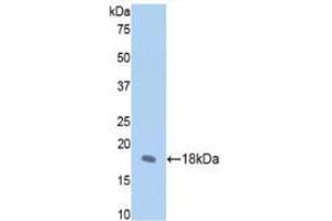 Western blot analysis of recombinant Rat FBN1. (Fibrillin 1 anticorps  (AA 751-895))