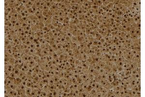 ABIN6260236 and ABIN6273993 at 1/100 staining Rat liver tissue by IHC-P. (BCL6 anticorps  (Internal Region))