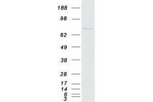 Validation with Western Blot