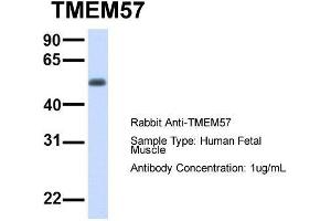 Host:  Rabbit  Target Name:  TMEM57  Sample Type:  Human Fetal Muscle  Antibody Dilution:  1. (TMEM57 anticorps  (N-Term))