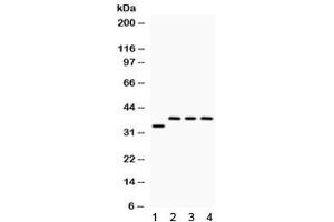 Western blot testing of 1) rat brain, 2) human SW620, 3) human 22RV1 and 4) human Hela lysate with DARPP-32 antibody. (DARPP32 anticorps)