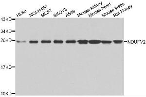 Western blot analysis of extracts of various cell lines, using NDUFV2 antibody. (NDUFV2 anticorps)
