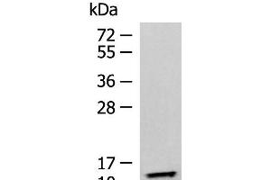 Western blot analysis of Human fetal liver tissue lysate using TMEM141 Polyclonal Antibody at dilution of 1:900 (TMEM141 anticorps)