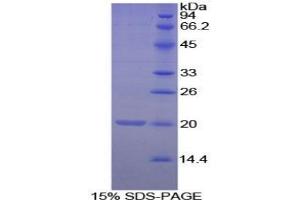 SDS-PAGE analysis of Mouse Matrix Gla Protein. (MGP Protéine)