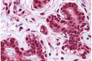 Human Breast: Formalin-Fixed, Paraffin-Embedded (FFPE) (LMBRD1 anticorps  (C-Term))