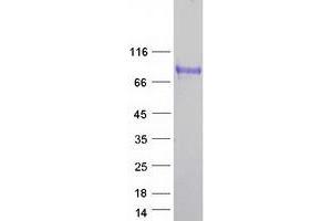Validation with Western Blot