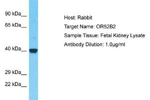 Host: Rabbit Target Name: OR52B2 Sample Type: Fetal Kidney lysates Antibody Dilution: 1. (OR52B2 anticorps  (C-Term))