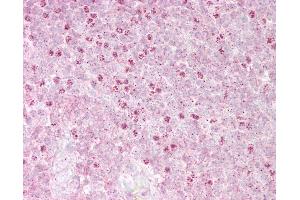 Anti-OAS1 antibody IHC of human tonsil.