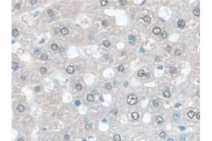 Detection of GSTm4 in Rat Liver Tissue using Polyclonal Antibody to Glutathione S Transferase Mu 4 (GSTm4)