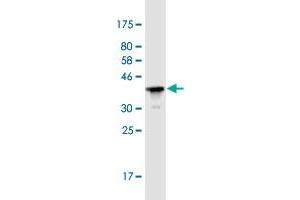 Western Blot detection against Immunogen (36. (Plakophilin 3 anticorps  (AA 225-324))