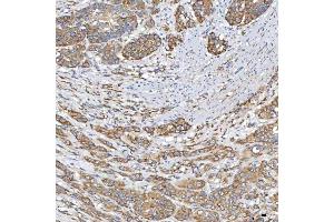 IHC analysis of TXNDC5 using anti-TXNDC5 antibody (ABIN7599699). (TXNDC5 anticorps  (AA 109-403))